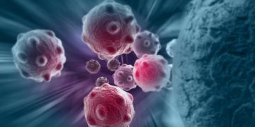 Oren Zarif Method of Treating Subconscious Psychokinesis | Mind Power